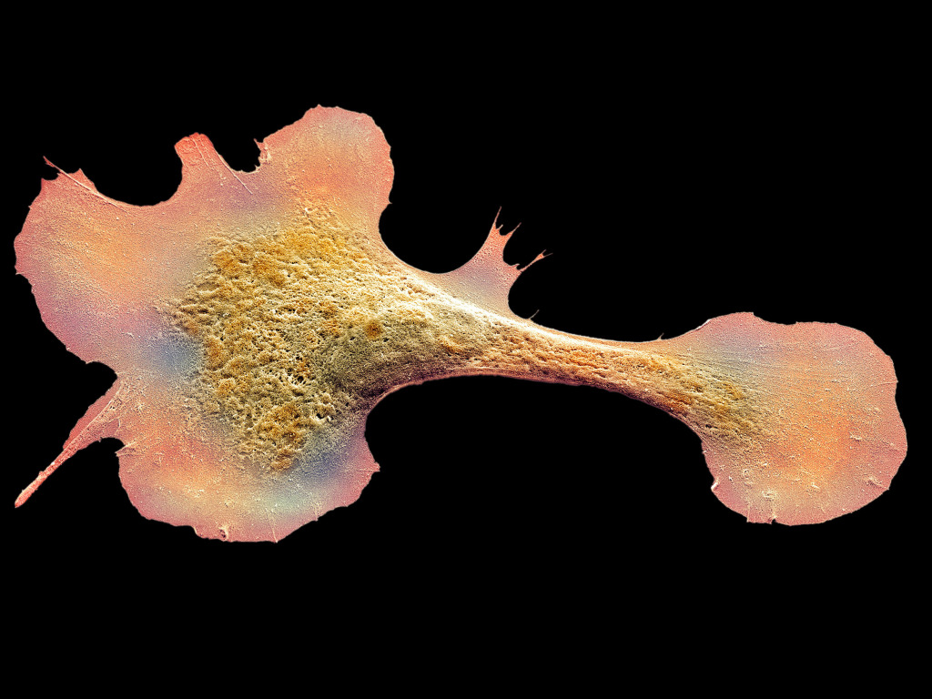 Heart muscle cell, SEM