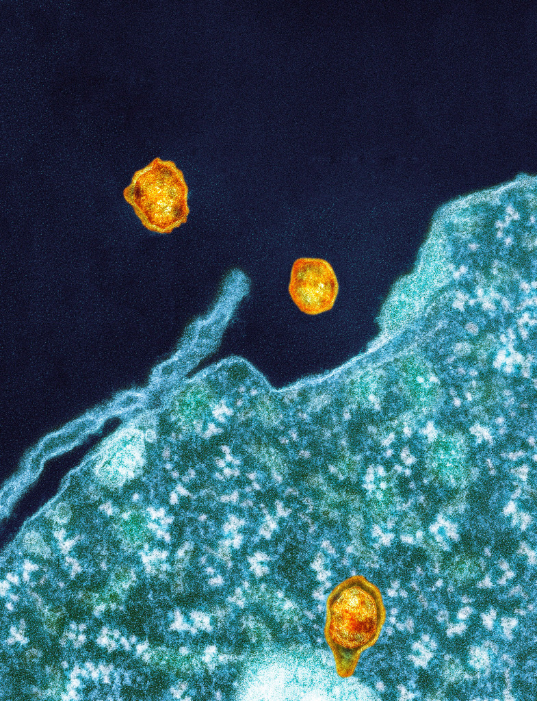 Hepatitis C viruses, TEM