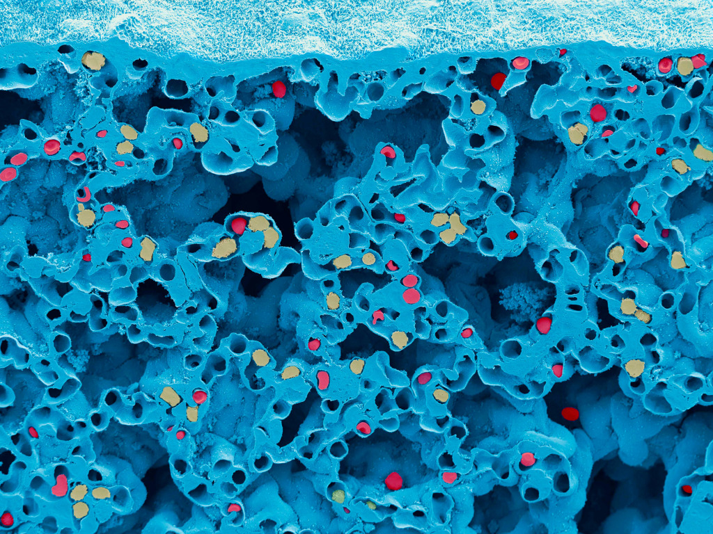 Lung tissue and blood cells, SEM