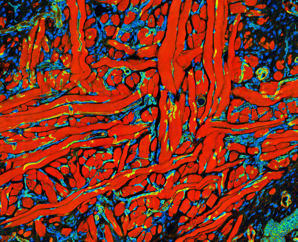 Tongue muscle tissue, confocal light micrograph