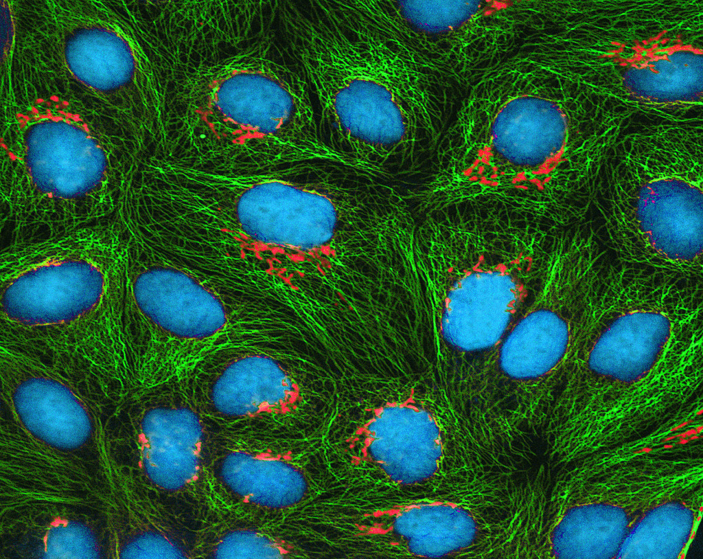 HeLa cells,fluorescence light micrograph