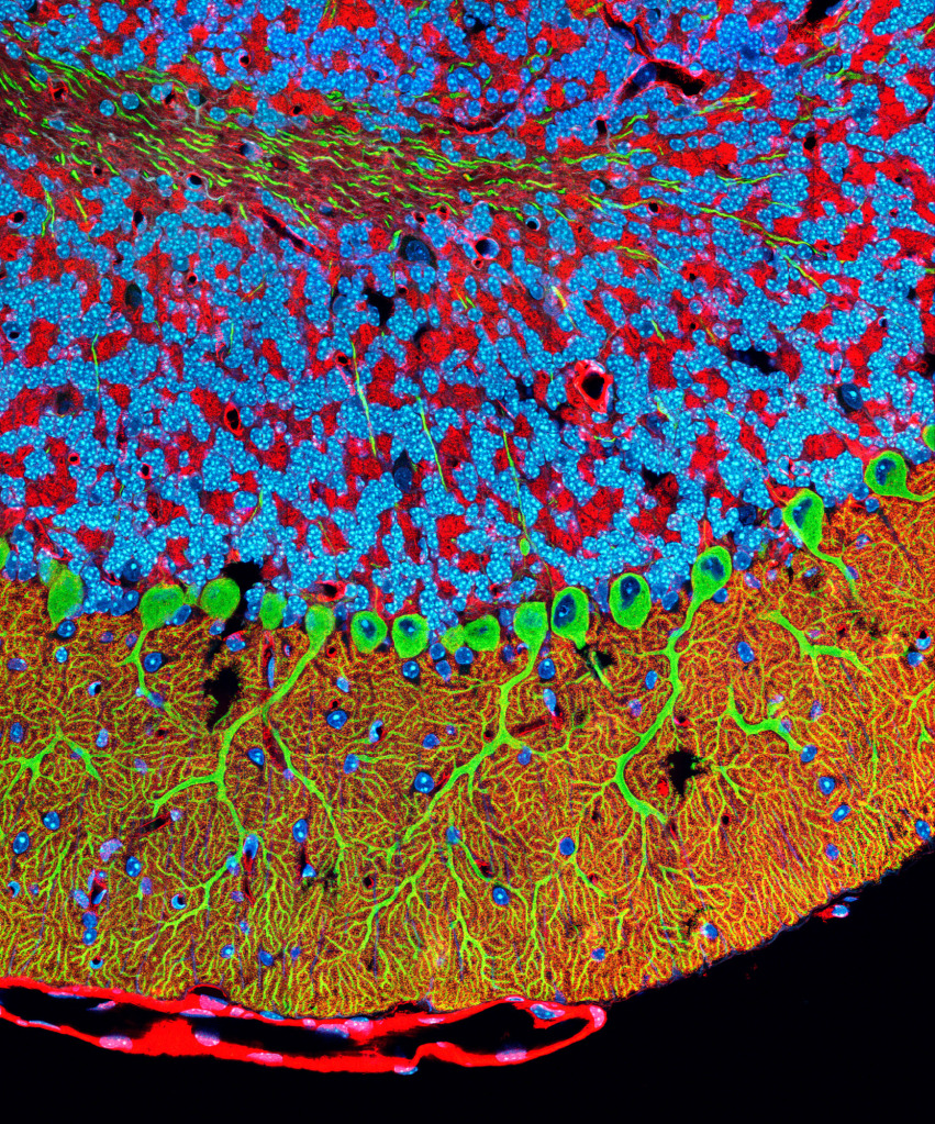 Purkinje nerve cells in the cerebellum