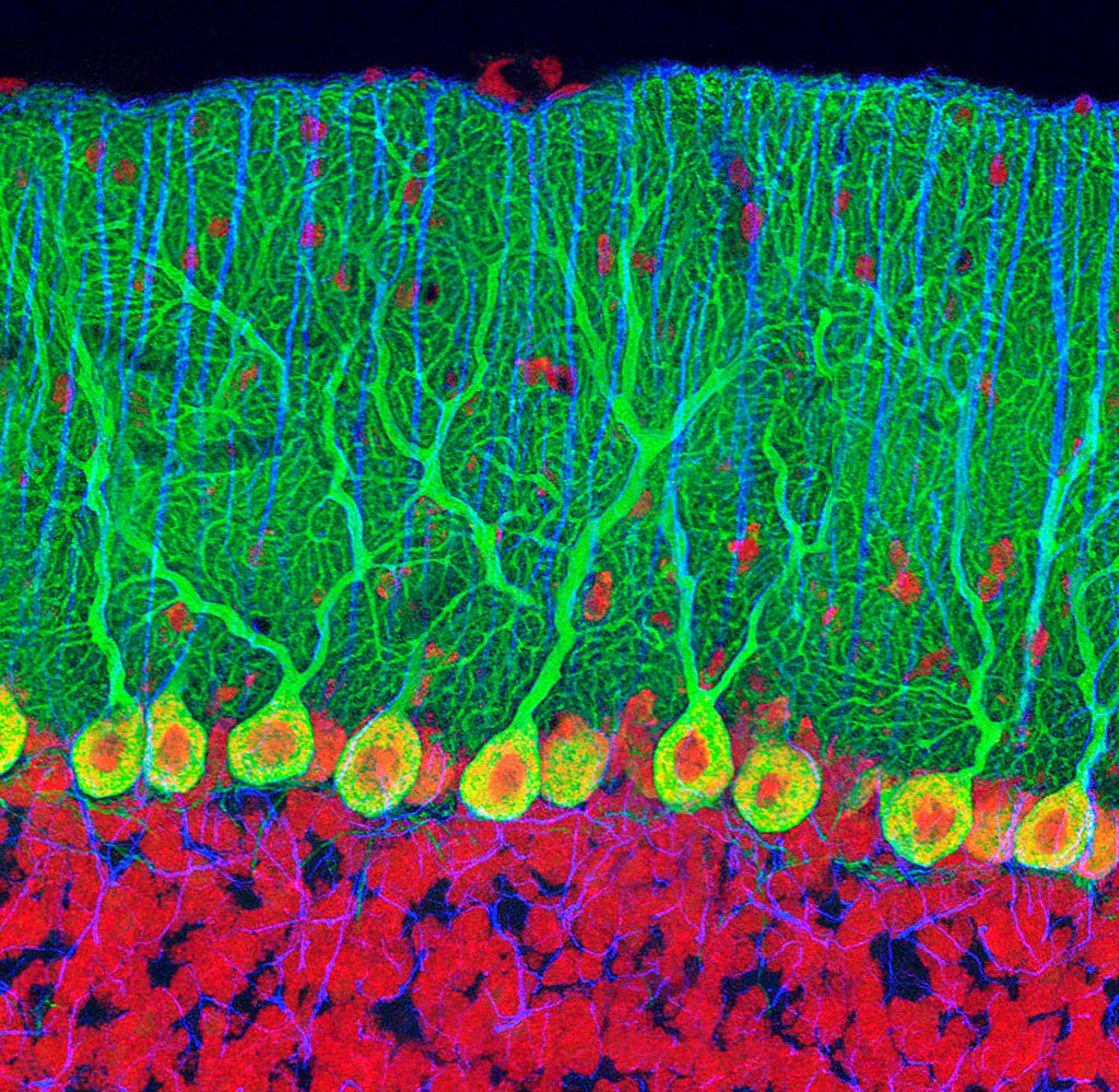 Purkinje nerve cells in the cerebellum