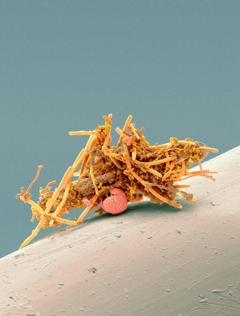 Used interdental brush, SEM