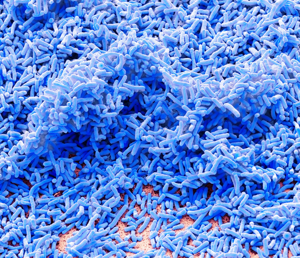 Pseudomonas bacteria, SEM