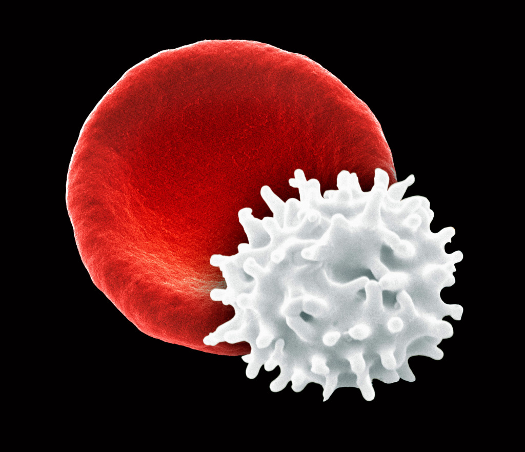 Healthy and crenated red blood cells, SEM