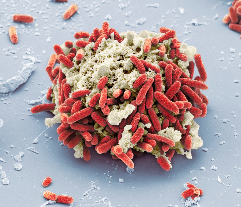 E. coli bacteria, SEM