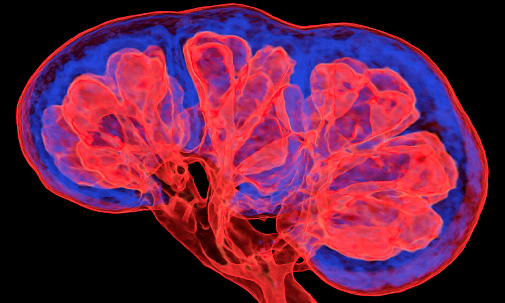 Kidney, CT scan