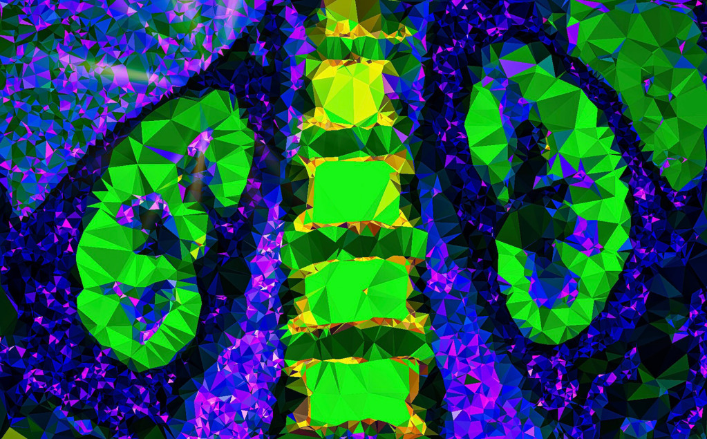 Kidneys, CT scan