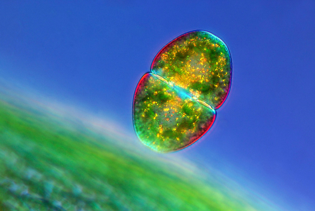 Cosmarium desmids, light micrograph