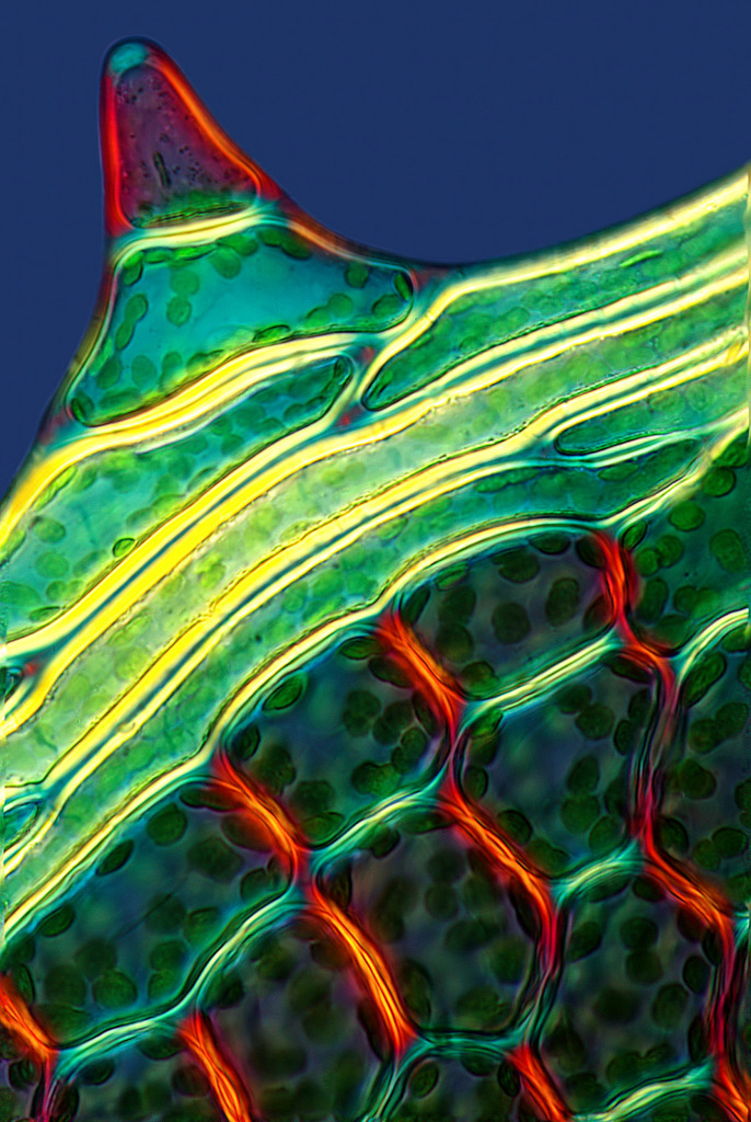 Moss, light micrograph