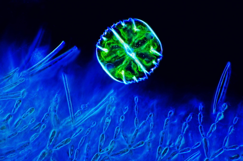 Desmid and red algae, light micrograph