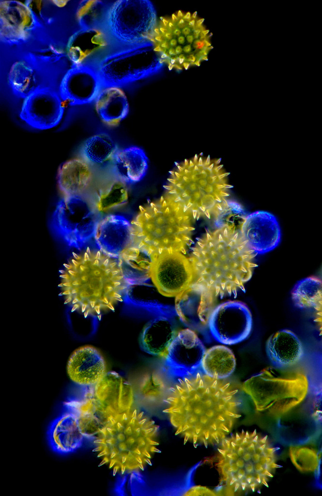 Pollen grains, light micrograph