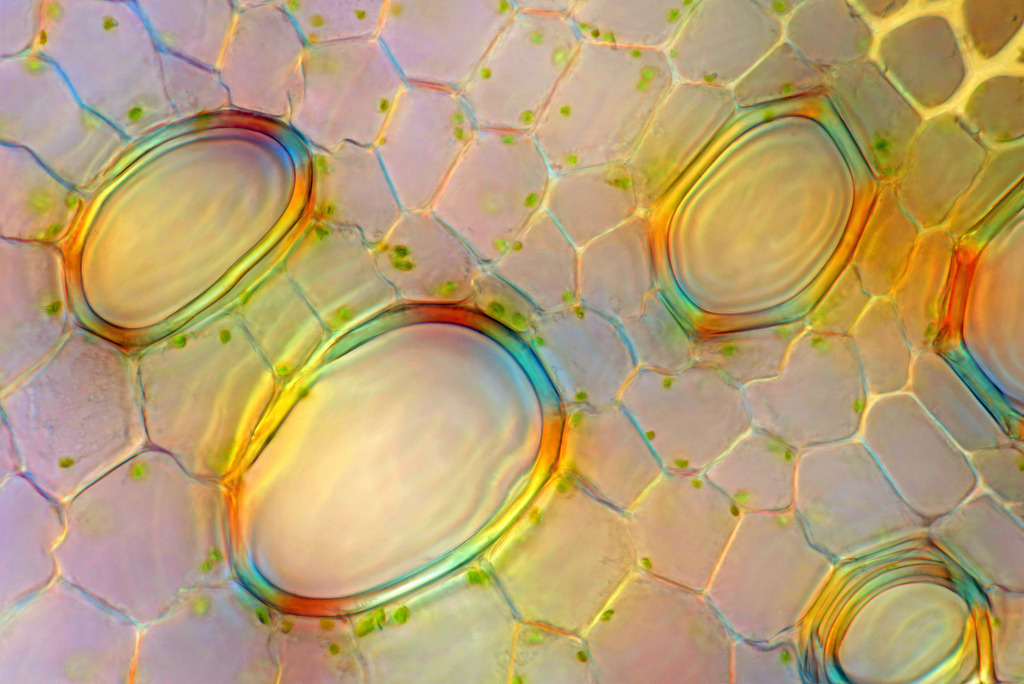 Touch-me-not (Impatiens sp.), light micrograph