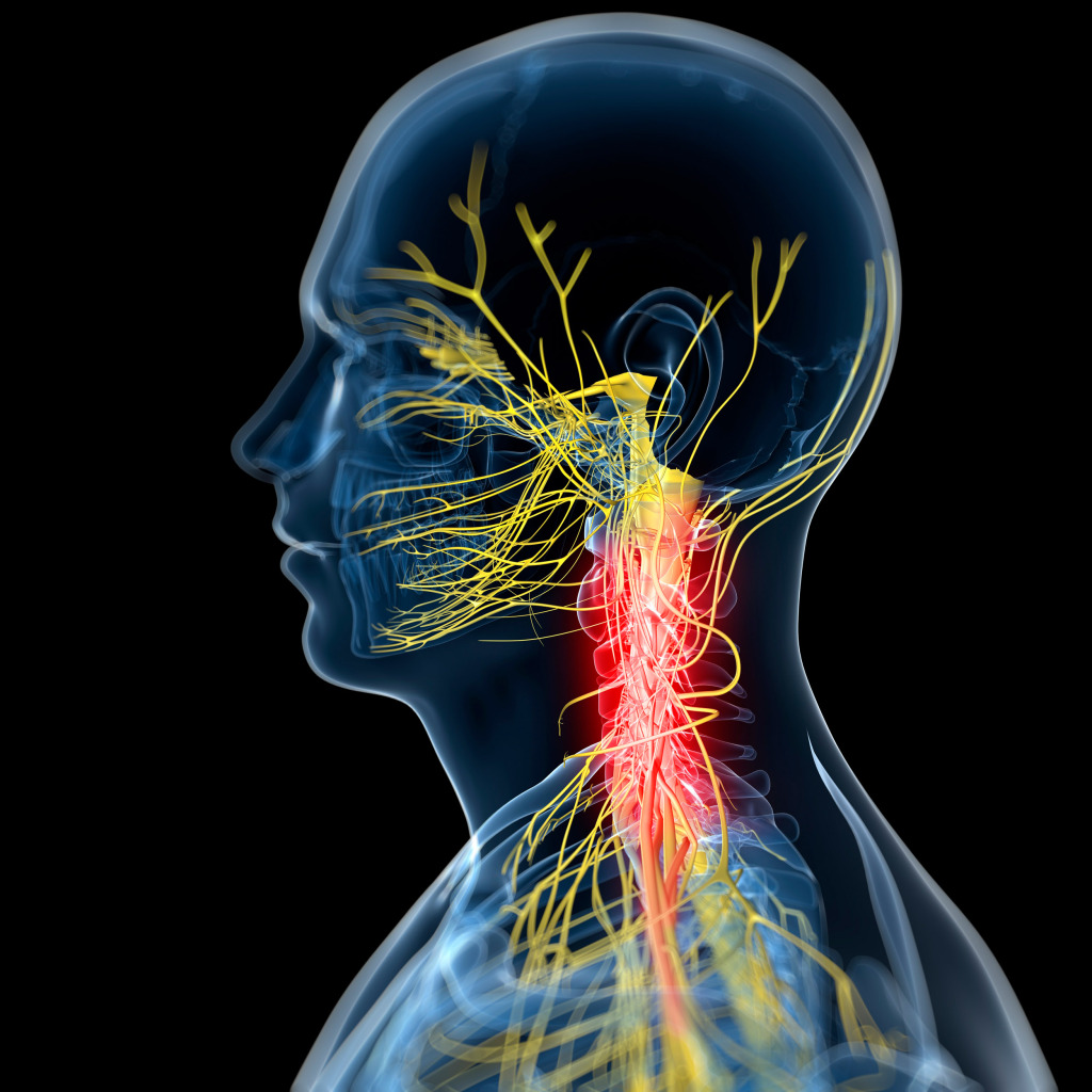 Neck pain, conceptual artwork