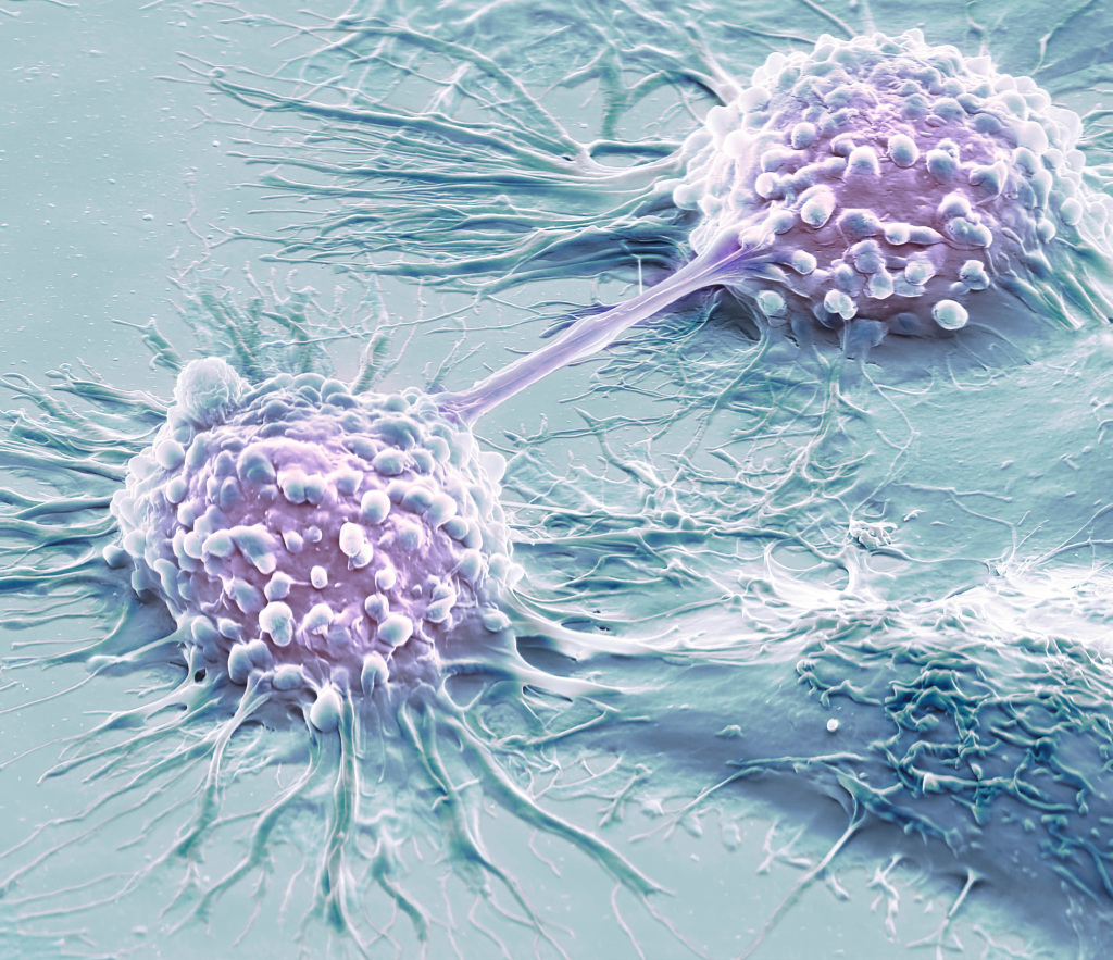 Cancer Cell Death – Science Photo Library