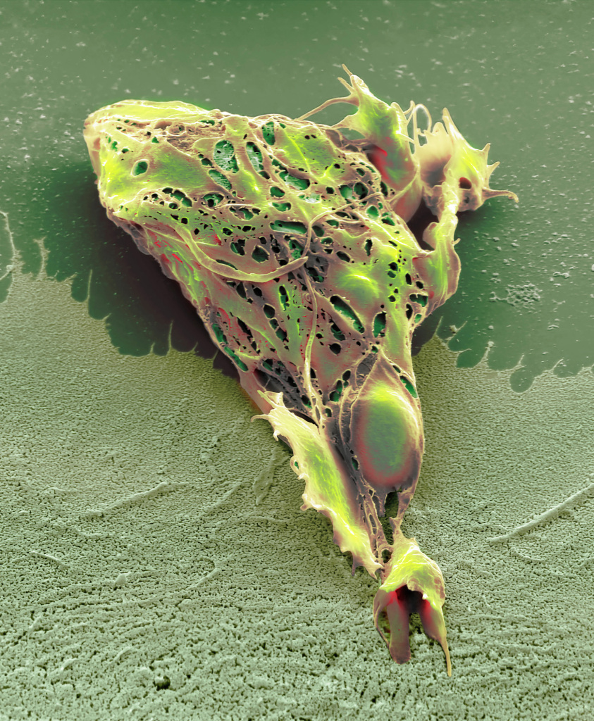 Chemotherapy induced cell death, SEM