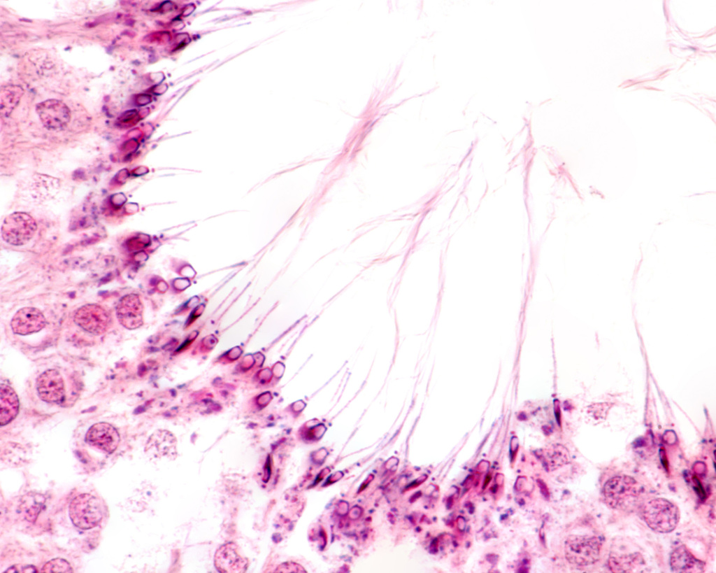 Human sperm centriole, light micrograph