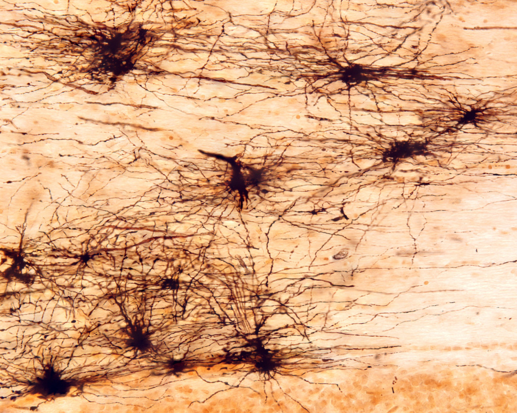 Fibrous astrocytes, light micrograph