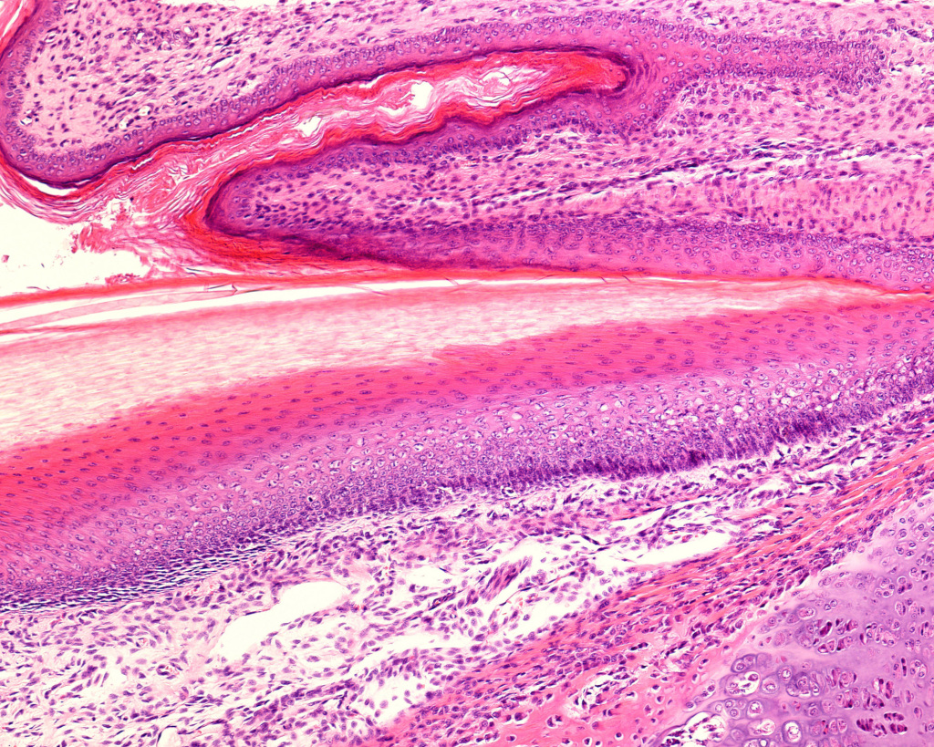 Nail, light micrograph