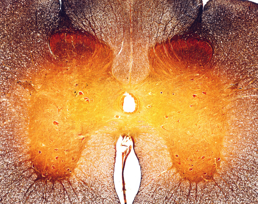 Human spinal cord, light micrograph