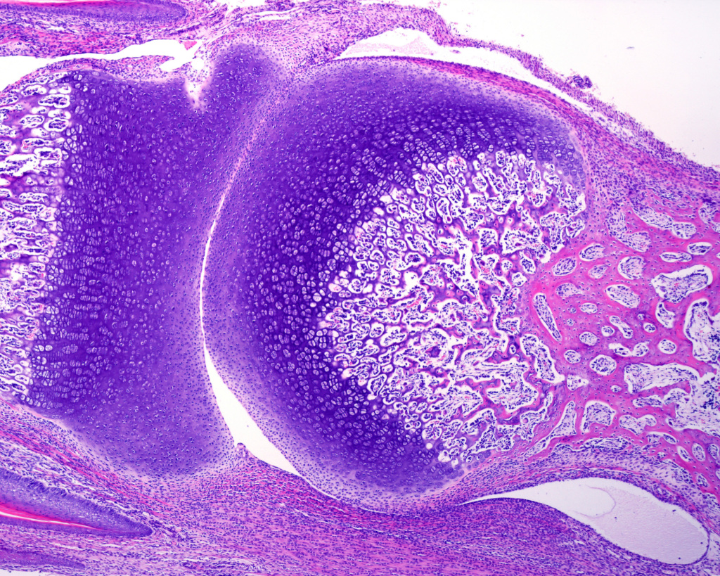 Developing joint, light micrograph